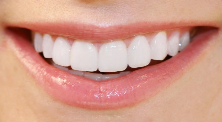 Kā dabiskiem līdzekļiem iegūt baltākus zobus 3 minūtēs (lieliska iedarbība)