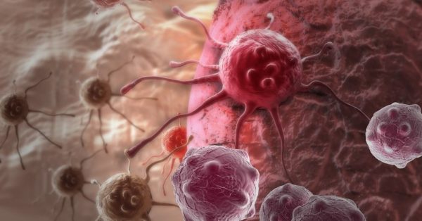 Vēža šūnu iznīcināšana: Lietojot šos 7 produktus, var apkarot vēža šūnas