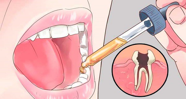 Kas remdē zobu sāpes: izskalojot muti ar šo līdzekli un tās mazināsies