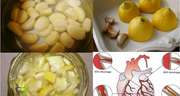 Citronu un ķiploku maisījums – iedarbīgākais līdzeklis sirdsdarbības normalizēšanai!