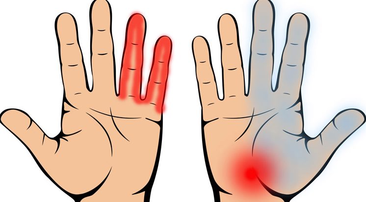 Diagnoze pēc rokām. Ko tās parāda par veselības stāvokli?