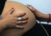 Grūtniece nezināja ko darīt, uzzinot ultrasonogrāfijas rezultātus; Speciālistiem tas bija neparedzēts pārsteigums